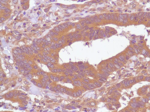 Immunohistochemistry (Formalin/PFA-fixed paraffin-embedded sections) - Anti-PI 3 Kinase p85 alpha antibody [SP62] (AB225720)