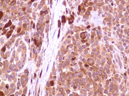 Immunohistochemistry (Formalin/PFA-fixed paraffin-embedded sections) - Anti-PI 3 Kinase p85 alpha antibody [SP62] (AB225720)