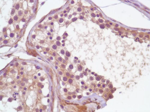 Immunohistochemistry (Formalin/PFA-fixed paraffin-embedded sections) - Anti-PI 3 Kinase p85 alpha antibody [SP62] (AB225720)