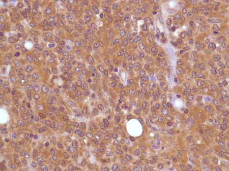 Immunohistochemistry (Formalin/PFA-fixed paraffin-embedded sections) - Anti-PI 3 Kinase p85 alpha antibody [SP62] (AB225720)