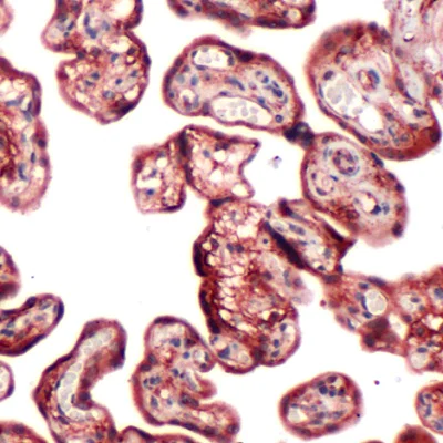 Immunohistochemistry (Formalin/PFA-fixed paraffin-embedded sections) - Anti-PI 3 Kinase p85 alpha antibody [SP62] (AB225720)
