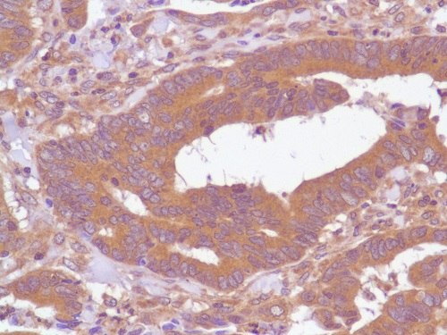 Immunohistochemistry (Formalin/PFA-fixed paraffin-embedded sections) - Anti-PI 3 Kinase p85 alpha antibody [SP62] - BSA and Azide free (AB236440)