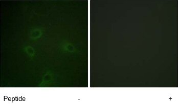 Immunocytochemistry/ Immunofluorescence - Anti-PI 3 Kinase p85 alpha + Gamma antibody (AB74136), expandable thumbnail
