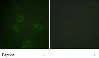 Immunocytochemistry/ Immunofluorescence - Anti-PI 3 Kinase p85 alpha + Gamma antibody (AB74136)