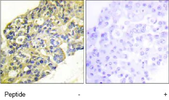 Immunohistochemistry (Formalin/PFA-fixed paraffin-embedded sections) - Anti-PI 3 Kinase p85 alpha + Gamma antibody (AB74136)