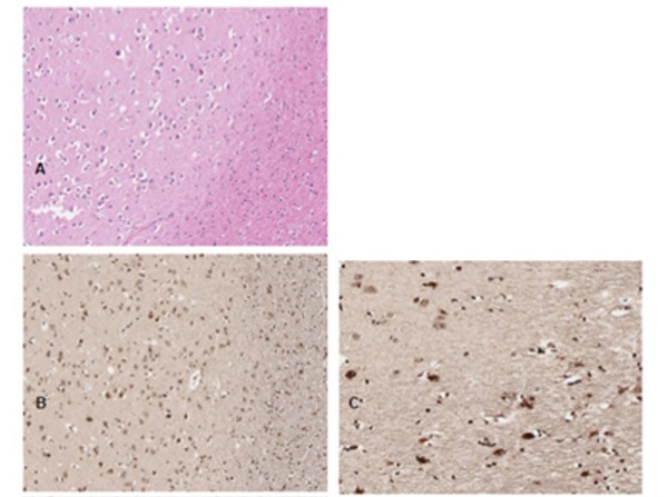 Immunohistochemistry (Formalin/PFA-fixed paraffin-embedded sections) - Anti-PI 3 Kinase p85 alpha (phospho Y607) antibody (AB235266)