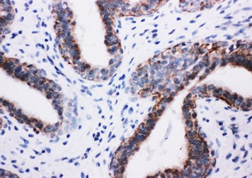 Immunohistochemistry (Formalin/PFA-fixed paraffin-embedded sections) - Anti-PI 3 Kinase p85 beta antibody (AB131067)