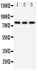Western blot - Anti-PI 3 Kinase p85 beta antibody (AB131067)