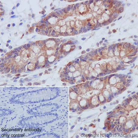 Immunohistochemistry (Formalin/PFA-fixed paraffin-embedded sections) - Anti-PI 3 Kinase p85 beta antibody [EPR18416] (AB180967)