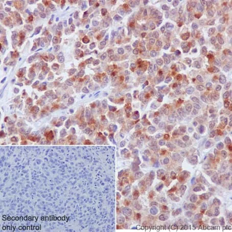 Immunohistochemistry (Formalin/PFA-fixed paraffin-embedded sections) - Anti-PI 3 Kinase p85 beta antibody [EPR18416] (AB180967)