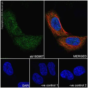 Immunocytochemistry/ Immunofluorescence - Anti-PI 3 Kinase p85 beta antibody [EPR18416] - BSA and Azide free (AB231161)