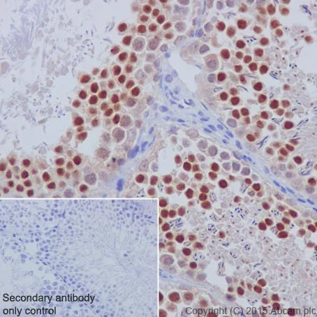 Immunohistochemistry (Formalin/PFA-fixed paraffin-embedded sections) - Anti-PI 3 Kinase p85 beta antibody [EPR18416] - BSA and Azide free (AB231161)