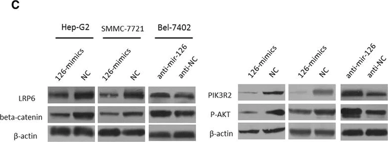 Western blot - Anti-PI 3 Kinase p85 beta antibody [T15] (AB28356)
