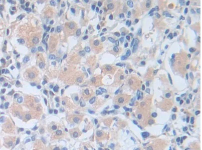 Immunohistochemistry (Formalin/PFA-fixed paraffin-embedded sections) - Anti-PI-9 antibody (AB233443)