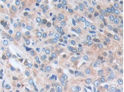 Immunohistochemistry (Formalin/PFA-fixed paraffin-embedded sections) - Anti-PI-9 antibody (AB233443)