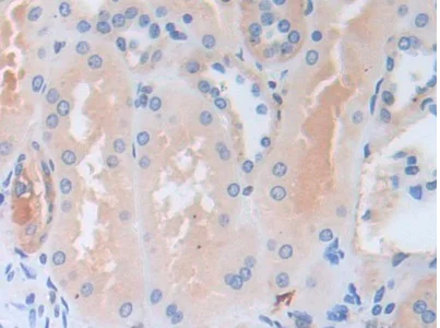 Immunohistochemistry (Formalin/PFA-fixed paraffin-embedded sections) - Anti-PI-9 antibody (AB233443)