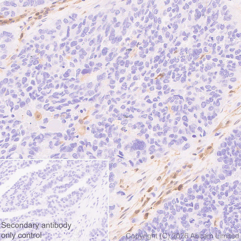 Immunohistochemistry (Formalin/PFA-fixed paraffin-embedded sections) - Anti-PI-9 antibody [EPR30517-563] (AB325928)