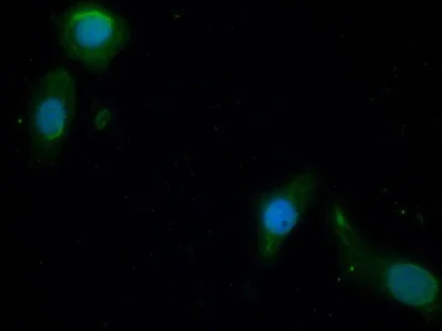 Immunocytochemistry/ Immunofluorescence - Anti-PI3 Kinase p110 beta antibody (AB232997)