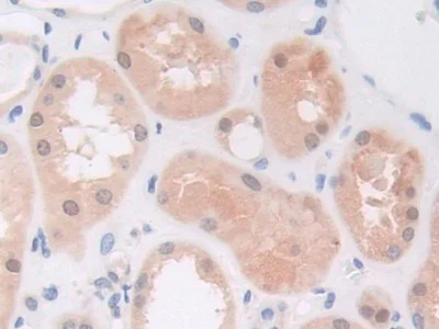 Immunohistochemistry (Formalin/PFA-fixed paraffin-embedded sections) - Anti-PI3 Kinase p110 beta antibody (AB232997)