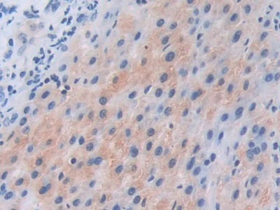 Immunohistochemistry (Formalin/PFA-fixed paraffin-embedded sections) - Anti-PI3 Kinase p110 beta antibody (AB232997)