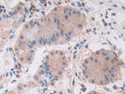 Immunohistochemistry (Formalin/PFA-fixed paraffin-embedded sections) - Anti-PI3 Kinase p110 beta antibody (AB232997)