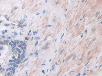 Immunohistochemistry (Formalin/PFA-fixed paraffin-embedded sections) - Anti-PI3 Kinase p110 beta antibody (AB232997)