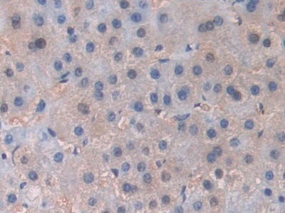 Immunohistochemistry (Formalin/PFA-fixed paraffin-embedded sections) - Anti-PI3 Kinase p110 beta antibody (AB232997)