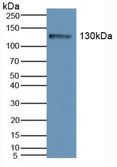 Western blot - Anti-PI3 Kinase p110 beta antibody (AB232997)