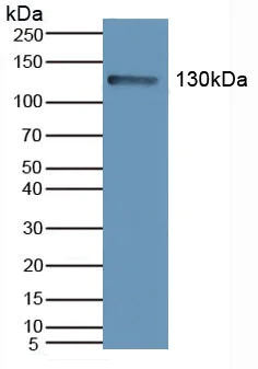 Western blot - Anti-PI3 Kinase p110 beta antibody (AB232997)