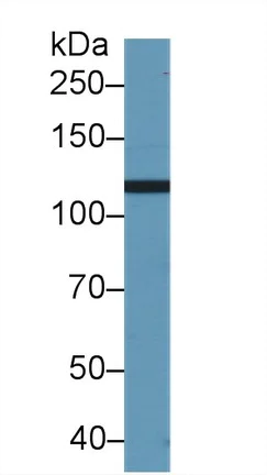 Western blot - Anti-PI3 Kinase p110 beta antibody (AB232997)