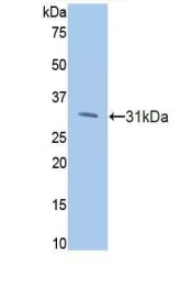 Western blot - Anti-PI3 Kinase p110 beta antibody (AB232997)