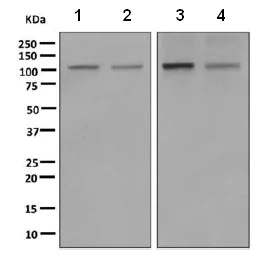 Western blot - Anti-PI3 Kinase p110 beta antibody [EPR5515(2)] (AB151549)