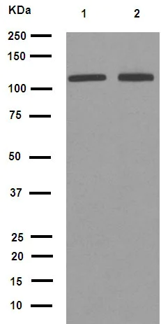 Western blot - Anti-PI3 Kinase p110 beta antibody [EPR5515(2)] (AB151549)