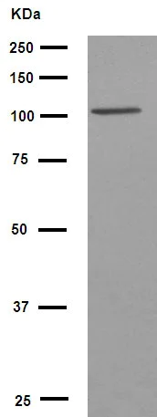 Western blot - Anti-PI3 Kinase p110 beta antibody [EPR5515(2)] (AB151549)