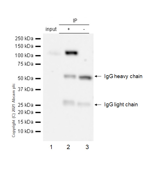 Immunoprecipitation - Anti-PI3 Kinase p110 beta antibody [Y384] (AB32569), expandable thumbnail