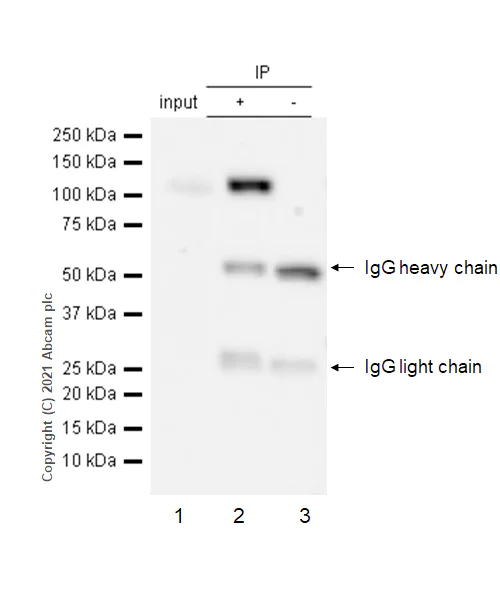Immunoprecipitation - Anti-PI3 Kinase p110 beta antibody [Y384] (AB32569)