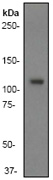 Western blot - Anti-PI3 Kinase p110 beta antibody [Y384] (AB32569), expandable thumbnail