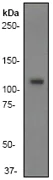 Western blot - Anti-PI3 Kinase p110 beta antibody [Y384] (AB32569)