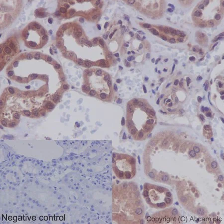 Immunohistochemistry (Formalin/PFA-fixed paraffin-embedded sections) - PI3K/AKT signalling pathway panel (AB283852)