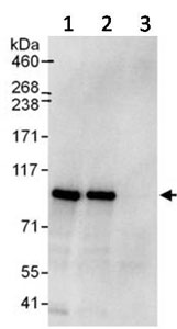 Immunoprecipitation - Anti-PI4 kinase beta/PI4KB antibody (AB134756)