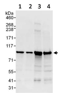 Western blot - Anti-PI4 kinase beta/PI4KB antibody (AB134756)