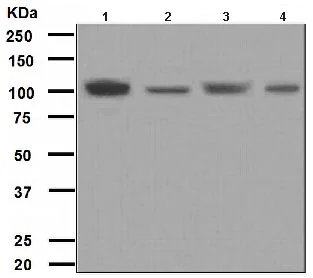 Western blot - Anti-PI4 kinase beta/PI4KB antibody [EPR3758(2)] - BSA and Azide free (AB247852)