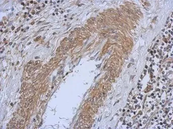Immunohistochemistry (Formalin/PFA-fixed paraffin-embedded sections) - Anti-PI4KA antibody (AB111565)