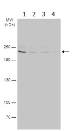 Western blot - Anti-PI4KA antibody (AB111565)