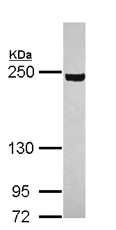 Western blot - Anti-PI4KA antibody (AB111565), expandable thumbnail
