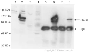 Western blot - Anti-PIAS1 antibody (AB32219)
