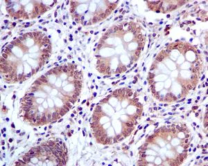 Immunohistochemistry (Formalin/PFA-fixed paraffin-embedded sections) - Anti-PIAS1 antibody [EPR2580(2)] (AB109388)