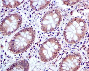 Immunohistochemistry (Formalin/PFA-fixed paraffin-embedded sections) - Anti-PIAS1 antibody [EPR2580(2)] - BSA and Azide free (AB239973)