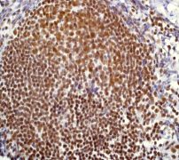 Immunohistochemistry (Formalin/PFA-fixed paraffin-embedded sections) - Anti-PIAS1+PIAS2 antibody [EPR2581Y] - BSA and Azide free (AB247490), expandable thumbnail