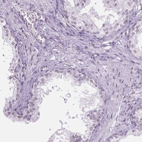 Immunohistochemistry (Formalin/PFA-fixed paraffin-embedded sections) - Anti-PIAS2 antibody (AB244538)